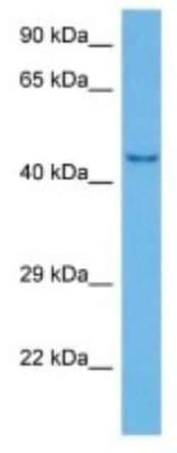 OCT6. Rabbit anti-Mouse, Polyclonal, Novus Biologicals 100 &mu;g | Buy Online | Novus Biologicals | Fisher Scientific